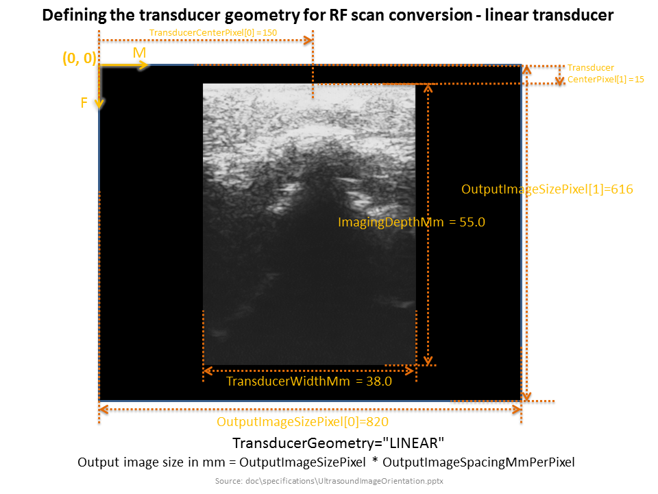 AlgorithmRfProcessingLinearScanConversion.png