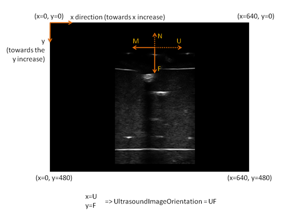 UltrasoundImageOrientationExample.png